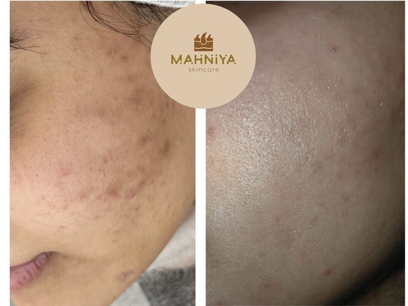 دکتر ساره علوی | دکتربین