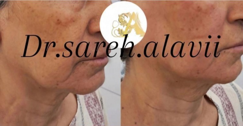 دکتر ساره  علوی  | دکتربین