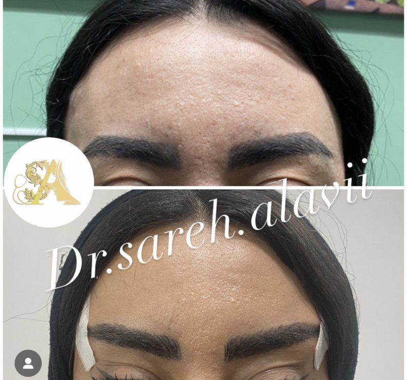 دکتر ساره  علوی  | دکتربین