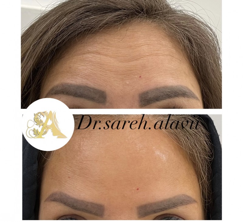 دکتر ساره علوی | دکتربین